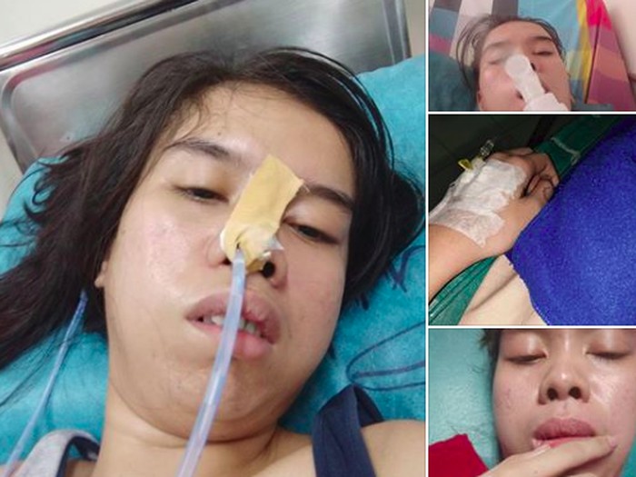 Viral Kisah Wanita Mengaku Kena Stroke Karena Kecanduan Mobile Legends