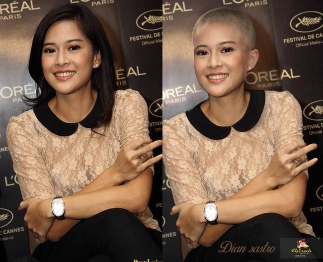 Dengan rambut botak, Dian Sastrowardoyo seperti orang yang lagi sakit.  Foto: Instagram/@edycomodo
