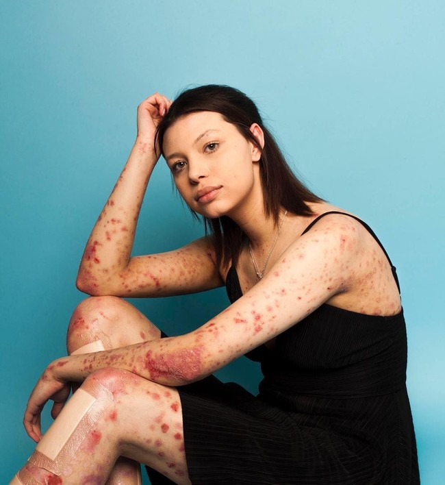 Walaupun kini percaya diri, tentu ada masa di mana Maya minder dengan penampilannya yang berbeda dari orang kebanyakan. Apalagi beberapa teman pernah mengejeknya ketika kecil. Foto: Instagram Maya Spencer-Berkeley