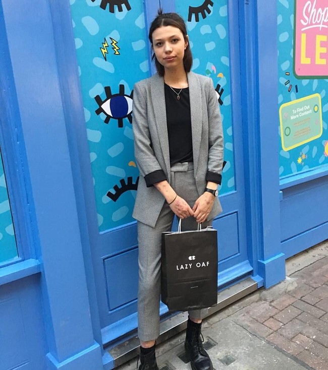 Rasa malu pun bukan satu-satunya hal yang harus ditanggung Maya karena kondisi kulitnya. Ia juga jadi punya rutinitas mandi yang lebih rumit dari orang kebanyakan. Foto: Instagram Maya Spencer-Berkeley