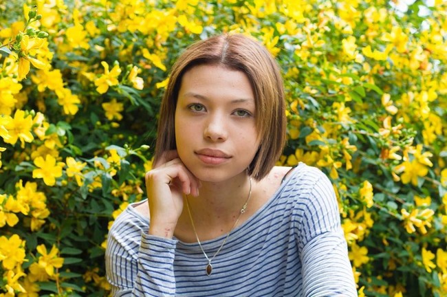 Selepas mandi, wanita itu lalu juga akan menggunakan plester dan membalut sejumlah luka. Setelahnya, Maya harus membersihkan luka-luka yang mengering atau terbuka setelah mandi agar tidak menempel di baju. Foto: Instagram Maya Spencer-Berkeley