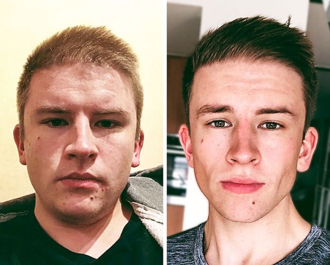 Berat badan pria ini turun 43 kg dalam setahun dengan olahraga dan tidak makan soda, permen, dan keripik. Foto: DonDrapeur/reddit.com