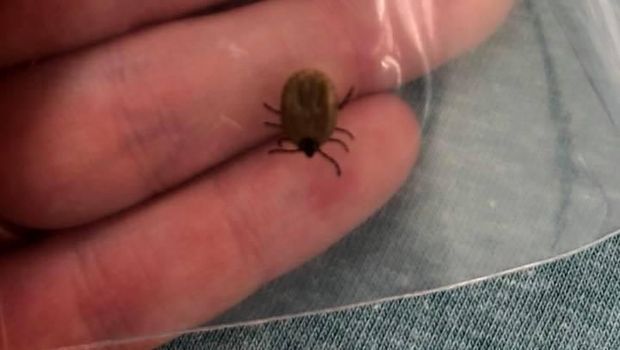 Kutu yang sebabkan Kailyn lumpuh sementara