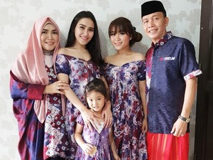 Kaki Aurel yang Jadi Sorotan, Ayu Ting Ting Pamer Pundak