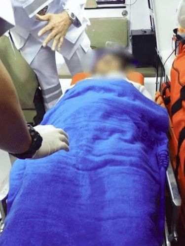 Ngeri! Pensil Alis Menancap di Mata Wanita Ini Saat Makeup Dalam Mobil