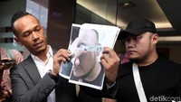 Febby Sagita selaku kuasa hukum Ronny mengatakan peristiwa tersebut terjadi di Jalan Arteri Pondok Indah, Jakarta Selatan pada Minggu, 10 Juni 2018.