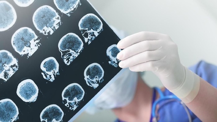 Foto: Thinkstock Foto: Thinkstock