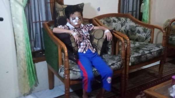 Bocah Rafa Korban Pelemparan Batu Sudah Bisa Melihat dan Bicara Bocah Rafa Korban Pelemparan Batu Sudah Bisa Melihat dan Bicara