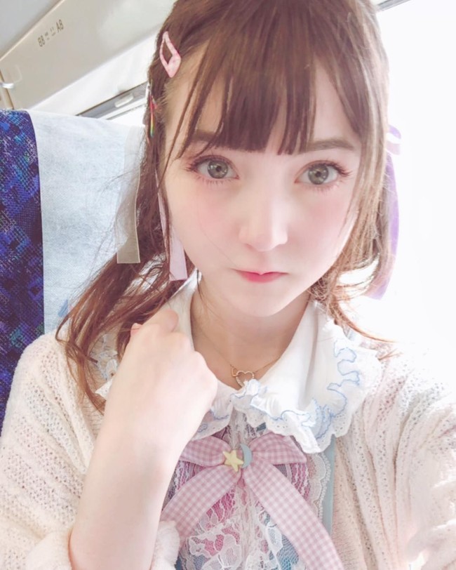 Venus menelepon 50 dokter di seluruh dunia, hanya satu yang mau menangani prosedur dramatis tersebut. Ia lalu terbang ke Korea Selatan untuk menjalani operasi pemotongan usus 120 cm dan mengecilkan perutnya.  Foto: dok. Instagram (Venus_Angelic)