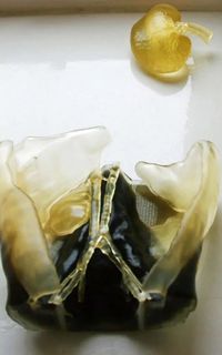 Teknologi Cetak 3D Bantu Transplantasi Ginjal Bocah 3 Tahun