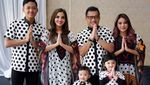 Abis di-Bully, Aurel Hermansyah Pamer Kaki di California