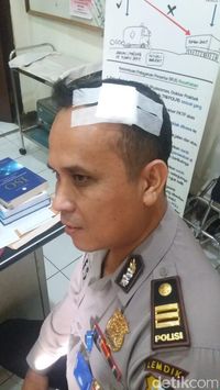 Korban Pemukulan Kombes Ekotrio Muntah hingga Luka Robek di Kepala