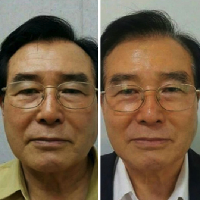 st ives anti aging krém legjobb anti aging bőrápoló termékek