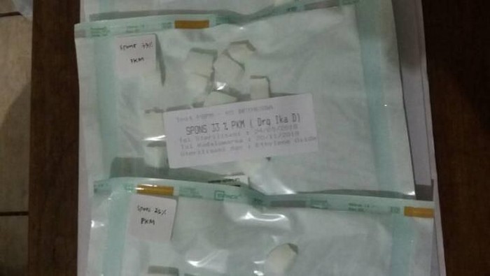Spons koral buatan buatan mahasiswa UGM. Foto: Dok. Oktika Spons koral buatan buatan mahasiswa UGM. Foto: Dok. Oktika