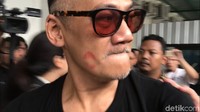 Tio tampak lebih kurus sesaat menjelang sidang.