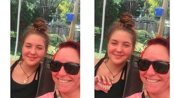 Bisakah kamu membuat saudariku terlihat giginya saat tersenyum? Foto: Instagram