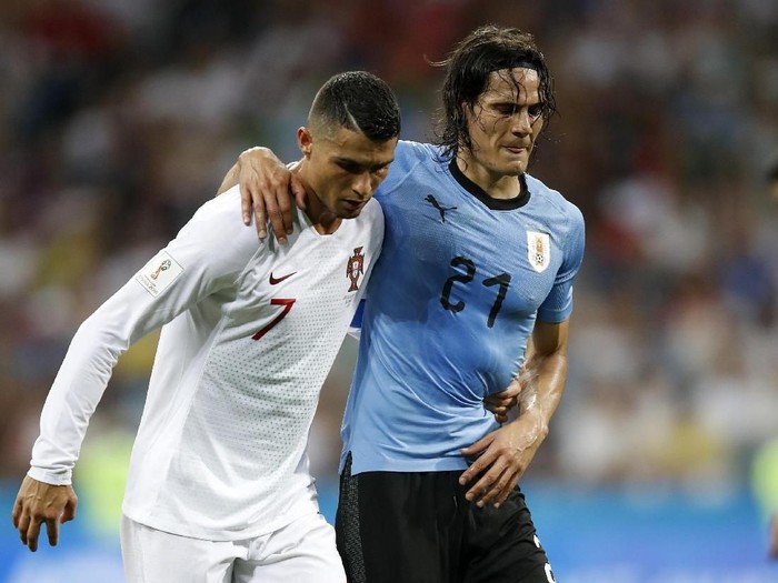 Cavani menahan nyeri diduga akibat cedera hamstring. (Foto: Dok) Cavani menahan nyeri diduga akibat cedera hamstring. (Foto: Dok)