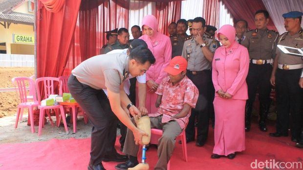 Sogiran mendapatkan kaki palsu