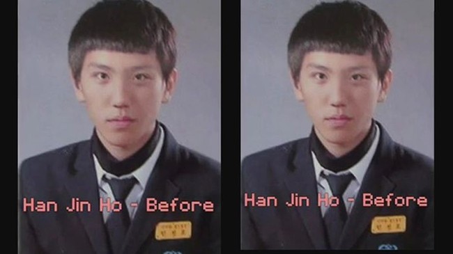 Kebanyakan orang tentu menyukai selfie. Beberapa menggunakan Photoshop untuk mengedit potret selfie dirinya menjadi lebih menarik sebelum diposting di media sosial. Tapi, pria di Korea ini memilih operasi plastik agar dirinya selalu terlihat seperti hasil editan Photoshop di dunia nyata.  Foto: Dok. Han Jin Ho