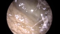 Ada juga kotoran telinga yang berbentuk seperti lendir ini. (Foto: YouTube)