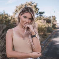 Awalnya, model yang tinggal di Selandia Baru ini memutuskan untuk operasi payudara karena terdapat benjolan di dada. Beberapa hari sebelum pemotretan impiannya dengan majalah Playboy, Sarah menjalani operasi darurat untuk mengangkat benjolan karena takut akan kanker Foto: Instagram