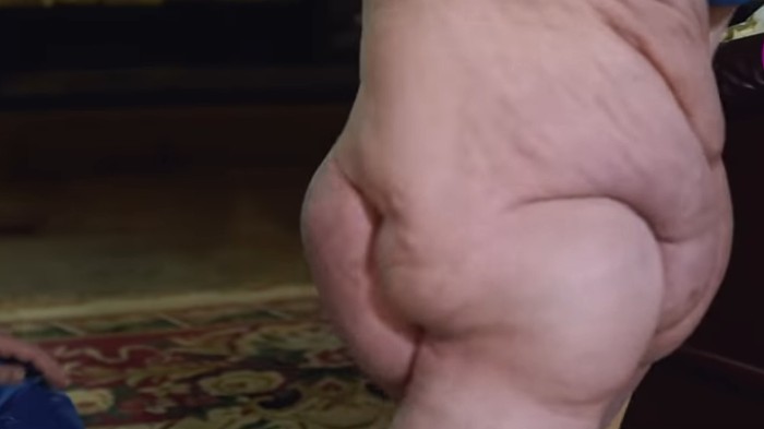 Wanita Ini Punya Satu Kaki Terbesar di Dunia, Beratnya 68 Kg. Foto: Youtube Wanita Ini Punya Satu Kaki Terbesar di Dunia, Beratnya 68 Kg. Foto: Youtube