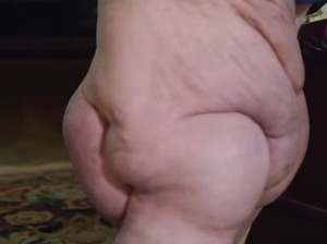 Wanita Ini Punya Satu Kaki Terbesar di Dunia, Beratnya 68 Kg