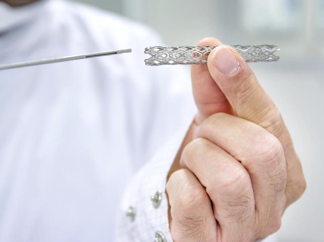 Arief Rivan Pakai Ring Jantung, Ini Fakta-fakta Alat Medis Tersebut