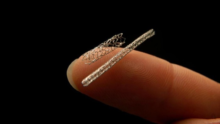 Apakah Semua Pasien Sakit Jantung Harus Pasang Ring? Begini Penjelasan Dokter