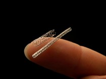 Apakah Semua Pasien Sakit Jantung Harus Pasang Ring? Begini Penjelasan Dokter