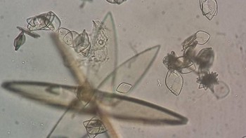 Berat badan berlebih juga bisa menjadi faktor yang meningkatkan risiko asam uratFoto: Instagram/kaksbb