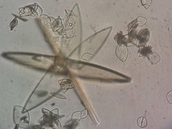 Cantik Tapi Mengerikan, Kristal Asam Urat di Bawah Lensa Mikroskop