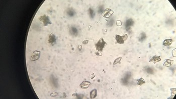 Untuk mendeteksi kristal asam urat bisa dilakukan dengan cara ultrasound (USG), cek darah, atau umumnya lewat pengambilan sampel urine. Foto: Instagram/prncsspsnts