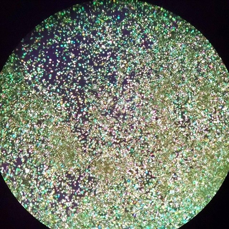 Akumulasi purin dalam kadar yang tinggi dalam tubuh bisa mengarah pada pengkristalan. Kristal cantik berbahaya itu dapat dilihat dari bawah lensa mikroskop.