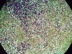 Cantik Tapi Mengerikan, Kristal Asam Urat di Bawah Lensa Mikroskop