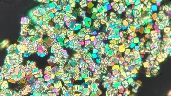 Kristal dapat terbentuk dari endapan purin yang terlalu lama. Foto: Instagram/josepoloni