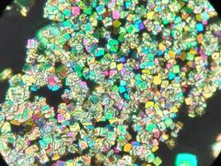 Cantik Tapi Mengerikan, Kristal Asam Urat di Bawah Lensa Mikroskop