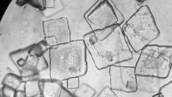 Urine itu akan dicek di bawah lensa mikroskop untuk melihat apakah ada kristal yang terbentuk di persendian. Foto: Instagram/gralabiol