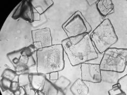 Cantik Tapi Mengerikan, Kristal Asam Urat di Bawah Lensa Mikroskop