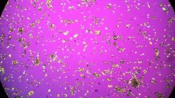 Jenis dan jumlah makanan yang dikonsumsi, kecepatan metabolisme, serta kepekatan urine menjadi penentu ada tidaknya kristal dalam urine seseorang. Foto: Instagram/atefoe