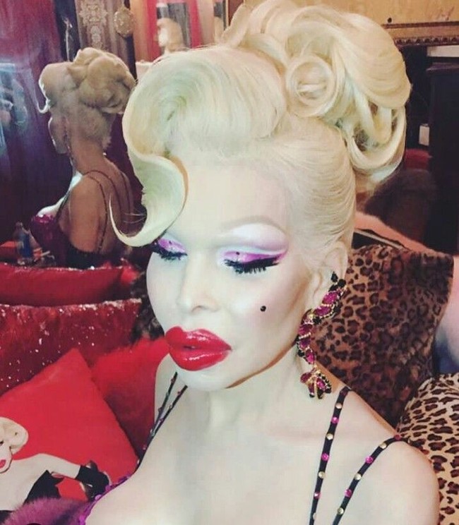 Amanda mengaku operasi yang paling menyakitkan sepanjang hidupnya adalah saat perubahan kelaminnya. Dari berbagai prosedur kecantikan yang telah ia lakukan, Amanda mengungkapkan bahwa dialah pemilik tubuh termahal di dunia. Foto: Instagram