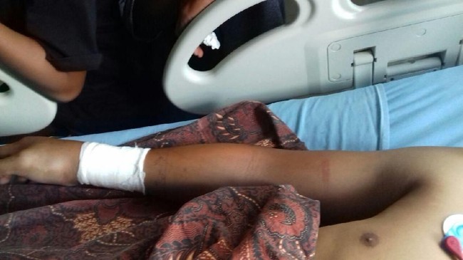 Fakta-fakta King Cobra yang Tewaskan Rizky di CFD