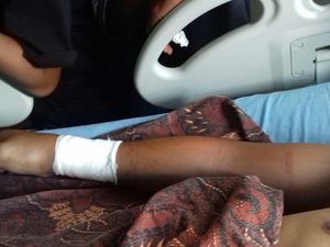 Keluarga Yakin Rizky Mati Suri Dipatuk King Cobra, Ini Respons RS