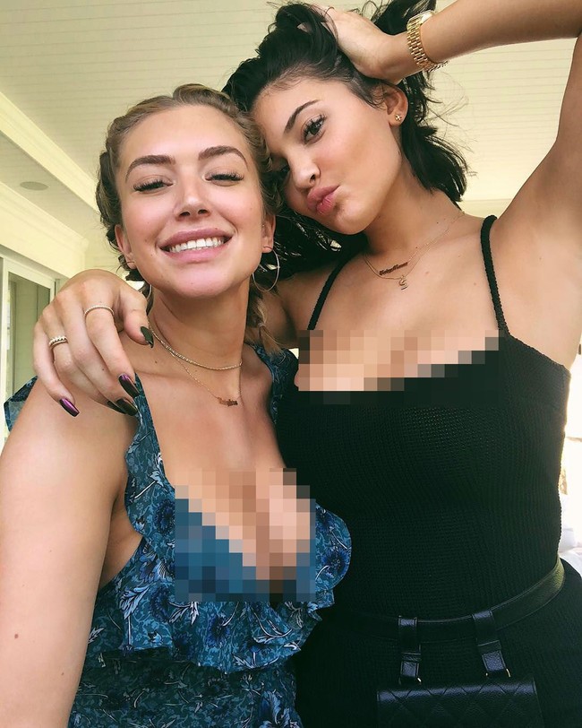 Baru-baru ini, Kylie pun tampil mengejutkan dengan bibirnya yang jauh lebih tipis dari sebelumnya. Secara tak terduga, Kylie mengaku tak lagi melakuan filler bibir. I got rid all of my filler, kata Kylie.  Foto: Instagram (@kyliejenner)