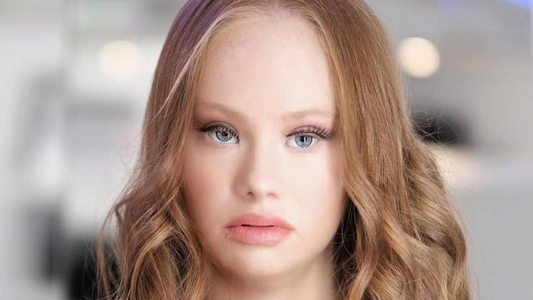 Cantiknya Maddy, Model Profesional Pertama dengan Down Syndrome