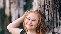Tak seperti wanita pada usianya. Ia merupakan wanita dengan down syndrome yang kini berhasil mengejar mimpinya sebagai model dan menjadi pusat perhatian di New York Fashion Week. Foto: Instagram/madelinesmodelling_