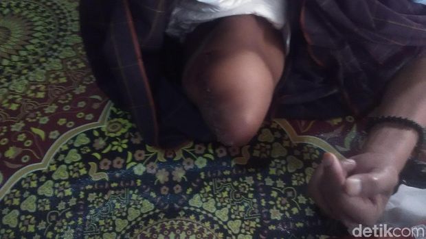 Kisah Pilu Kakek di Bandung Barat Huni Bekas Gudang Pakan Ayam