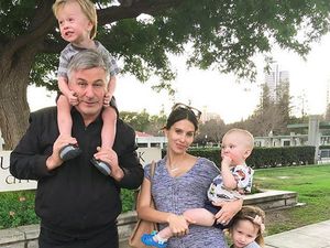 Curhat Istri Alec Baldwin tentang Rambut Rontok Usai Melahirkan