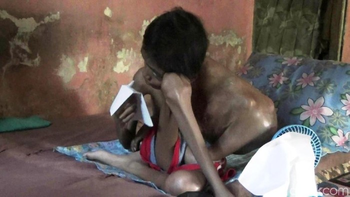 Tolong! Bocah Penderita Kanker Otot Ini Butuh Uluran Tangan