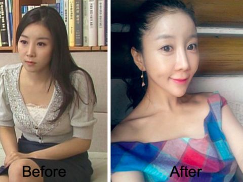 Jalani Operasi Plastik, Wajah Presenter Ini Malah Dikritik Netizen